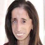 Lizzie Velasquez Age